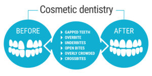 Cosmetic Dental Procedure AZ